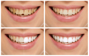 Dr. Garcia | New Age Dental | Cosmetic Dentistry | Katy, TX Dentist